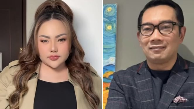 Mediasi atau Tersangka? Polisi Tentukan Nasib Lisa Mariana Pekan Ini