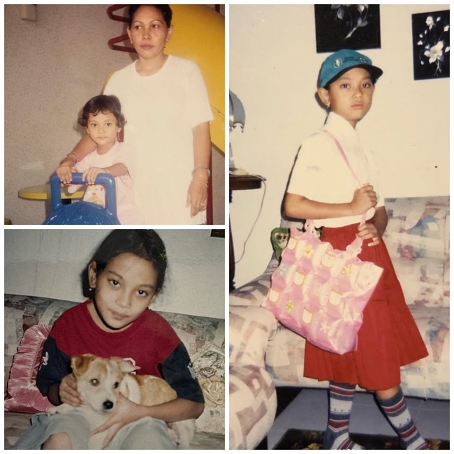 Perbedaan Wajah Erika Carlina Sebelum &amp; Sesudah Operasi, Disebut Beda Banget