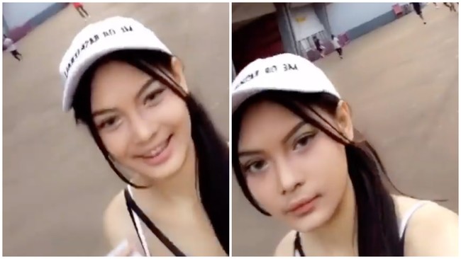 Perbedaan Wajah Erika Carlina Sebelum &amp; Sesudah Operasi, Disebut Beda Banget