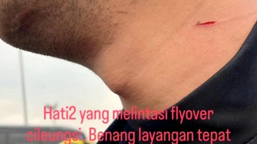 Viral Leher Pengendara motor Tersayat Benang Layangan di Flyover Cileungsi