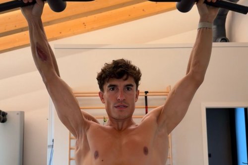 Foto Lengan Marc Marquez di Aragon Bikin Heboh