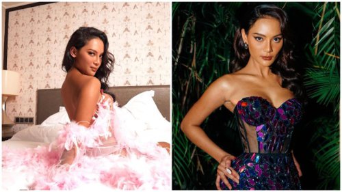 Perbedaan Wajah Erika Carlina Sebelum & Sesudah Operasi, Disebut Beda Banget