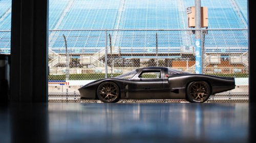 Here are the cars you could buy if you sold your organs