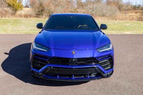 Here are the cars you could buy if you sold your organs